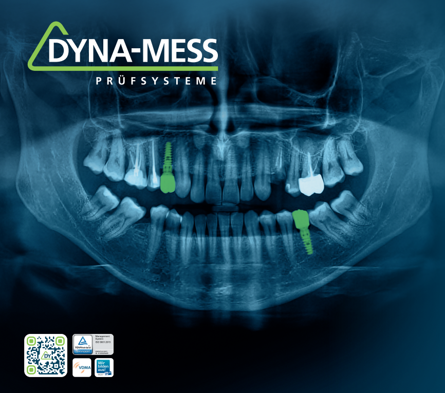 DYNA-MESS at IDS 2025